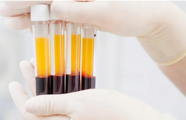 Плазмотерапия